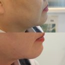 빛나눔보호작업장 | 금왕 피부관리, 빛으로 빚어내는 예술적인 페이스라인 뷰티 나눔 에스테틱