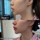 깨도독 | 다이어터들의 필수템 자밀라브이캔디 붓기캔디 후기