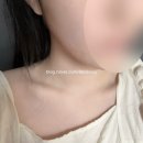 동전종합공구 | ✨[내돈내산] 홈모드 써마 리프트 10주차 💎 3개월 사용 Before&After✨ 명절 급찐 급빠
