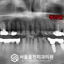 서울웅천치과의원 이미지
