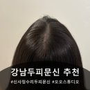 [신사smp] 오오스튜디오 신사점 강남정수리두피문신 후기 // 신사두피관리