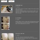 이레피부관리