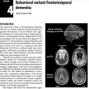 Re:Re:Frontotemporal Dimentia와 관련된 논문 2개 이미지