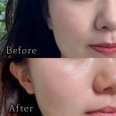 오로라 뷰티 | 오창 피부관리 오로라뷰티 유산균 엑소좀 케어, 환절기 건성 피부 살리는 닥토필 관리