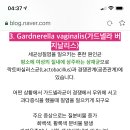 나 가드넬라균 질염 판정받았는데 여성청결제 하루에 1번쓰는데 그렇게 쓰지말래 너네는 여성청결제 며칠에 한번 써? 이미지