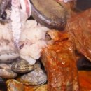 역전등뼈 이미지