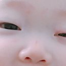 이종흔안과 네이버블로그