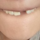충주열린치과의원 네이버블로그