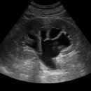 (주)유티비 이미지