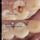 금천구 시흥동 치과 베스트e치과의원 위치 오는길 후기