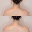 이규보로 | [인천/부평] 부평 피부·체형·윤곽관리 "유리햅에스떼" 페이스&amp;바디워크 관리 리뷰 후기