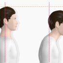 압구정노트정형외과의원 네이버블로그