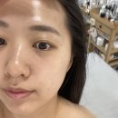 블랑드보떼 - 화성시 | 화성남양피부관리맛집 블랑드보떼 유산균 테라피추천 물방울초음파 스케일링 솔직후기 할인 및 주차정보