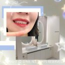 30대 직장인 치아미백 후기, 인천 계양구 치과 방문기