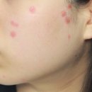 하나반점 이미지