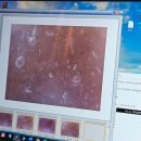 B10-2 | 결국 찾아간 비텐에스테틱(B10) 모공청소 리얼후기