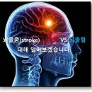 뇌졸중(stroke), 뇌경색 VS 뇌출혈 이미지