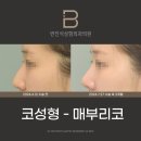변진석성형외과의원 네이버블로그