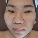오늘앤바디시흥장곡점 | [시흥바디관리] 오늘앤바디 시흥장곡점 물방울초음파 후기