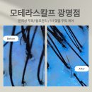 2188 | 모테라스칼프 광명점 두피관리 스케일링후기(산후탈모에 좋아요)