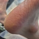 대신발 | 압구정역 풋케어샵 발굳은살 연고 대신 발관리 후기