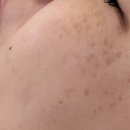 유니드케어 이미지