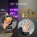 텐모텔 | 인제대 어방동 화이트태닝 8회차 솔직후기(화이트태닝 비포애프터 사진 많음)