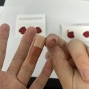 일등종합가스 | 바이오컴 종합대사기능분석+음식물과민증분석 솔직 후기