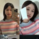 사랑니를부탁해치과 이미지