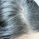 더블유헤어살롱 | 여성형탈모 모근강화 두피세정 탈모관리샴푸 HAMOCELL 더블유 헤어 로스 샴푸 후기 💜