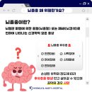 오늘 10월 29일(화) '뇌졸중의 날 "골든타임은 '무조건 빨리' 이미지