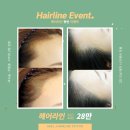 아델비어 이미지