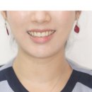 연세인스타일치과의원 이미지