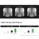 연세신동정형외과의원 네이버블로그