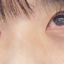 미소담은안과의원 이미지