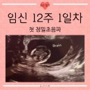 [24.10.28.] 임신일기 (54) :: 12w1d│신한은행 40주 맘적금 가입│아인병원 초기 정밀초음파 및 입체...