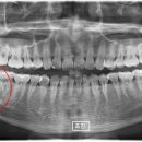 광교본치과의원 이미지