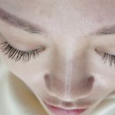 이랑비탈 - 남동구 | 이랑비탈