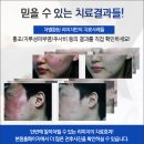 겨울 더 심해지는 남자안면홍조 피부과다녀봐도 소용없었다면 이미지