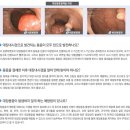 용*종