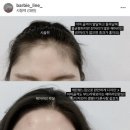 헤어라인왁싱 가격, 주기, 부작용 :: 대전 둔산동 바비라인 헤어라인왁싱 후기