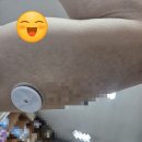 평화의료기 네이버블로그