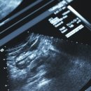 벌교보건지소 이미지