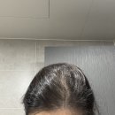 닥터정한의원 | 비오틴 추천 :: 닥터트루 프리미엄 유기농 비오틴으로 탈모예방하기