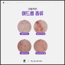 미라클케어 이미지