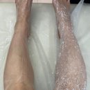 (주)프로페셔널 | 알렉산드리아 프로페셔널 슈가링왁싱 리터치 후기🫶