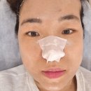 [공지] 대전피부관리 아티스트비에스 한남대점에서 스킨플래닝 받은후기