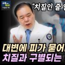 치질수술 절대 함부로 하지마세요. 치질을 수술없이 극복하는 방법. 치질 있다면 꼭 봐야할 영상. 이미지