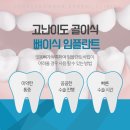 이고운치과 네이버블로그