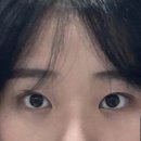 강남 매몰쌍수 후기(2주기록)